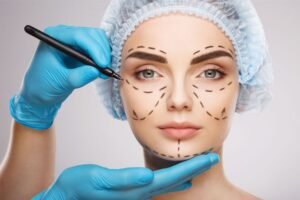 post operatorio