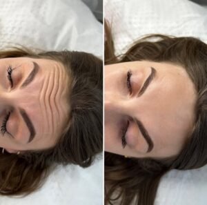 Antes y despues