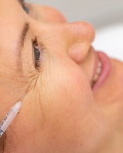 Bioestimulación