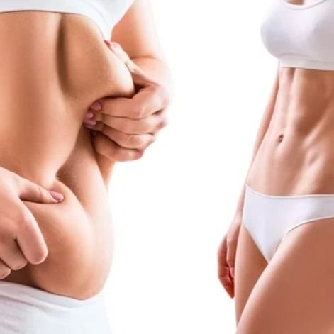 cuerpo