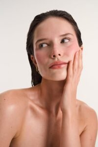 rosacea