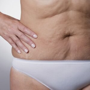 Flacidez corporal: causas reales